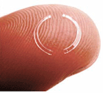 Intacs corneal ring on a finger
